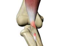 Biceps Tendon Repair